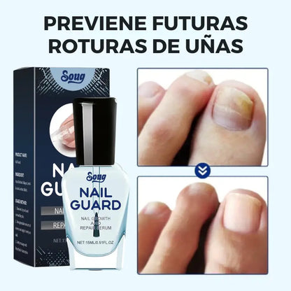 Nail-Guard – Suero Reparador y de Crecimiento de Uñas